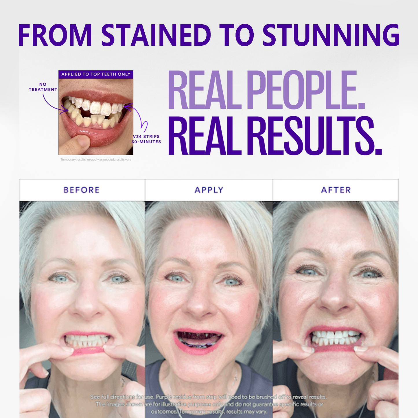 SmileFitPro™ V36 Whitening Strips – Professional Teeth Whitening at Home