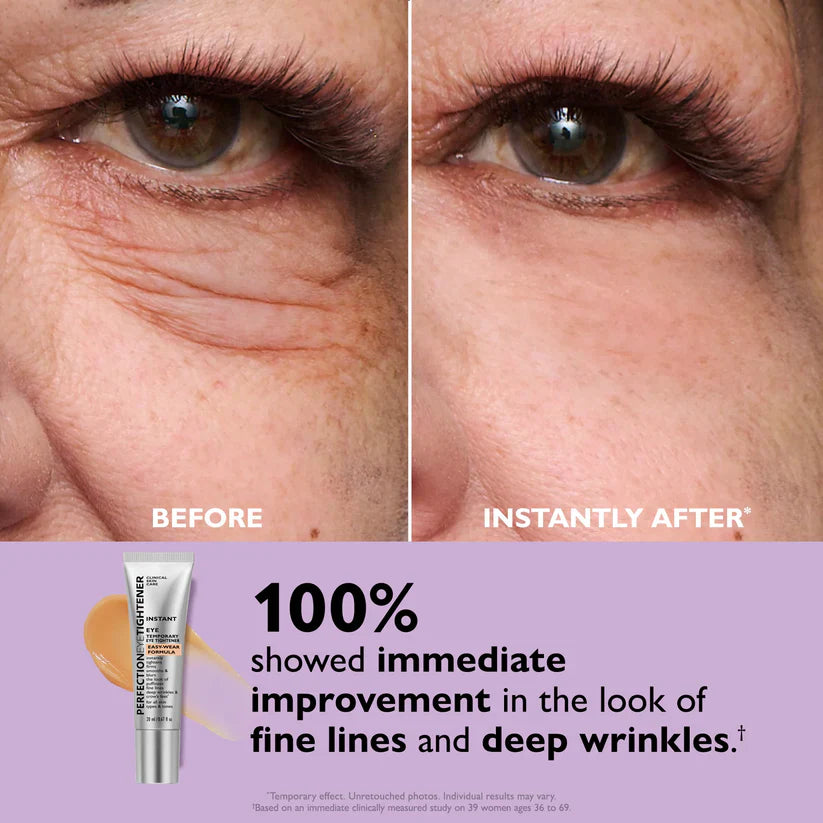 ✨Instant Wrinkle Eye Tightener Cream  (FREE BONUS BRUSH)
