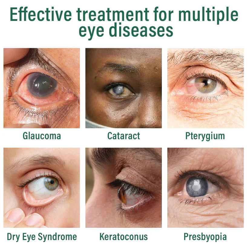 Nexisify® Nano Eye Drops Serum ✅FDA Approved(Suitable for presbyopia, dry eye syndrome, glaucoma, and cataracts) ☘️☘️