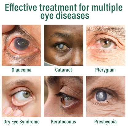 Nexisify® Nano Eye Drops Serum ✅FDA Approved(Suitable for presbyopia, dry eye syndrome, glaucoma, and cataracts) ☘️☘️