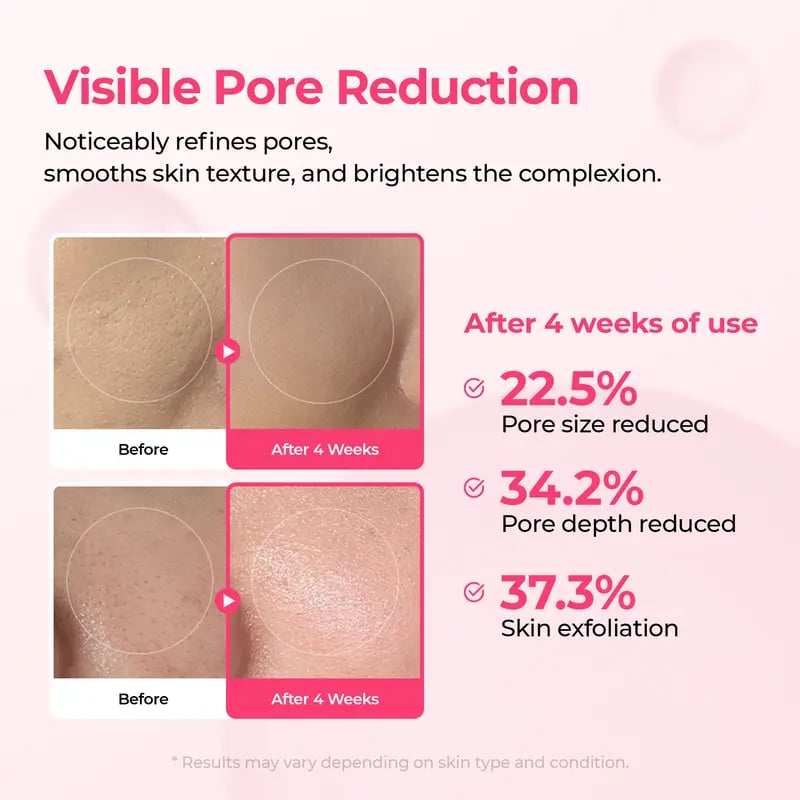 pore-spot-care-duo-5474