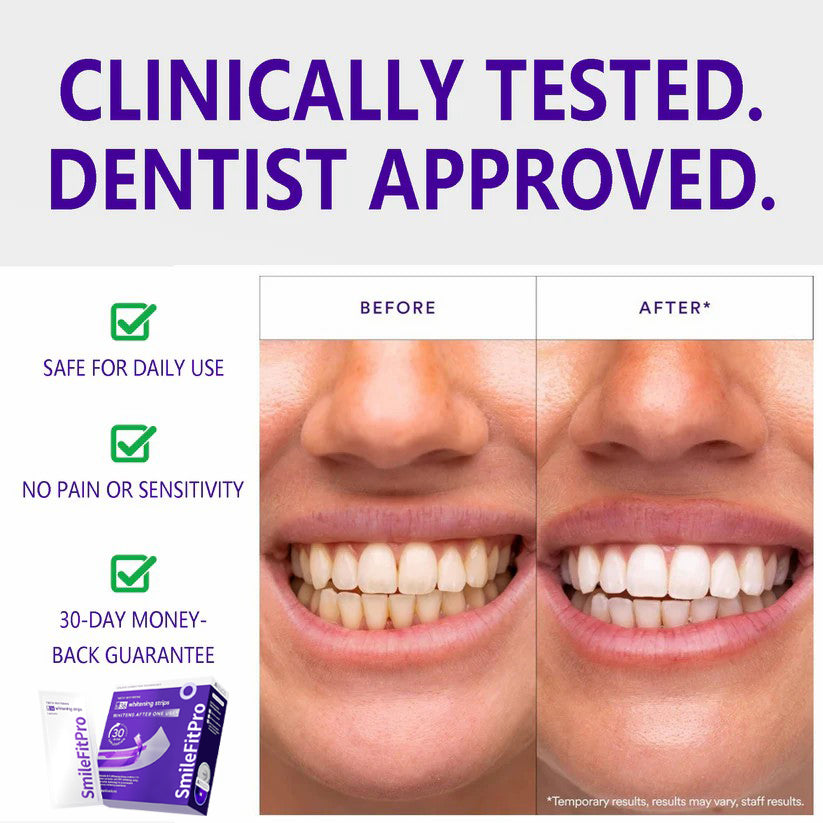 SmileFitPro™ V36 Whitening Strips – Professional Teeth Whitening at Home