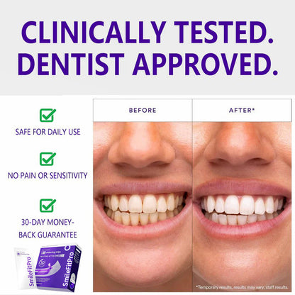 SmileFitPro™ V36 Whitening Strips – Professional Teeth Whitening at Home
