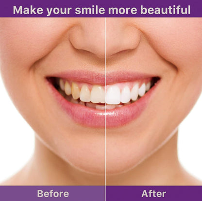 SmileFitPro™ V36 Whitening Strips – Professional Teeth Whitening at Home