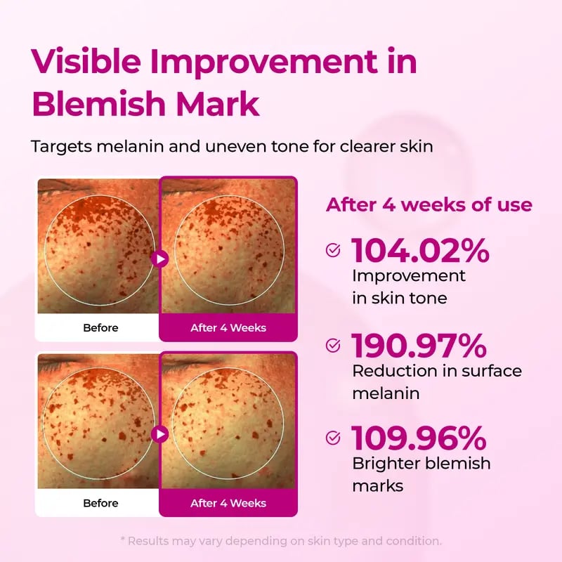 pore-spot-care-duo-5474