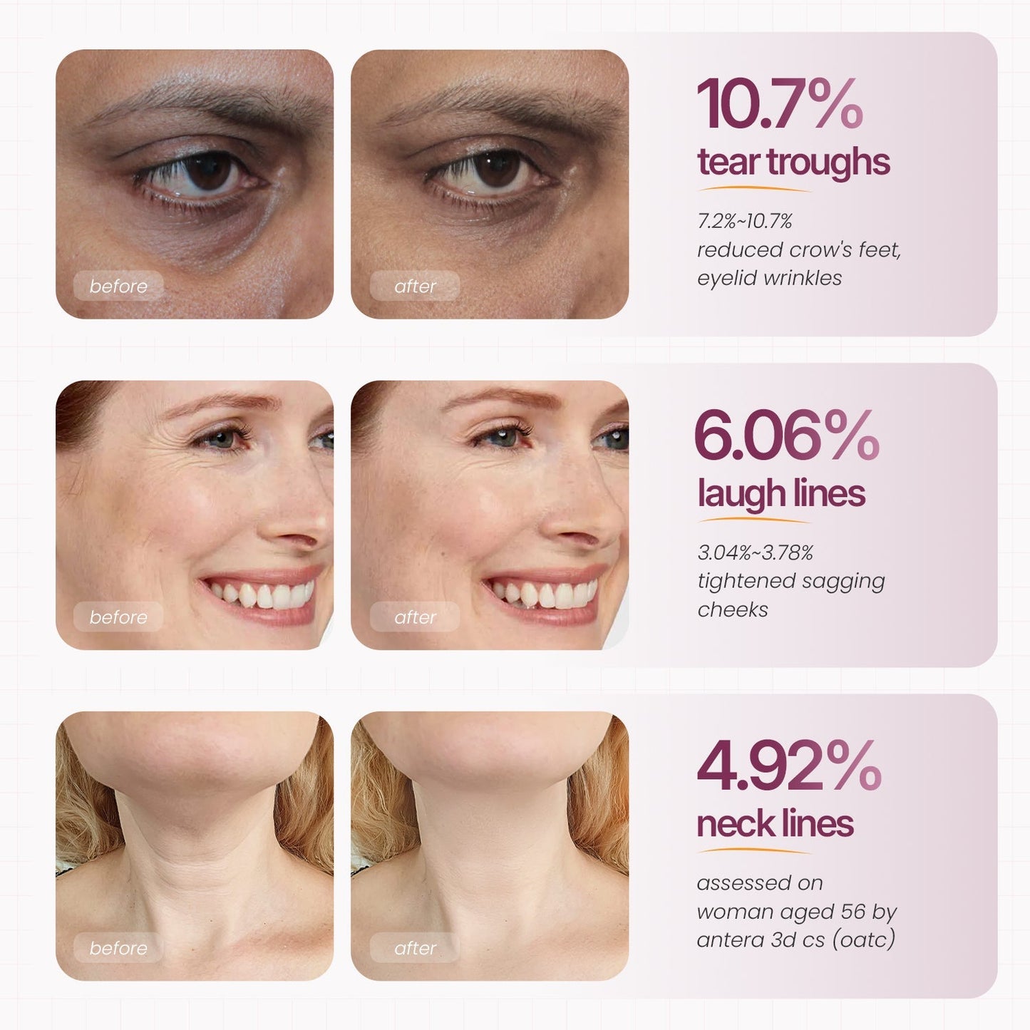 Calcium Multi Balm | Anti-aging, Sagging, Wrinkles