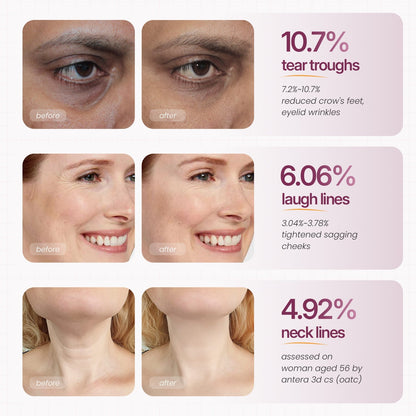 Calcium Multi Balm | Anti-aging, Sagging, Wrinkles