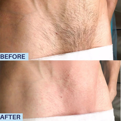 REFINED intimate hair removal cream