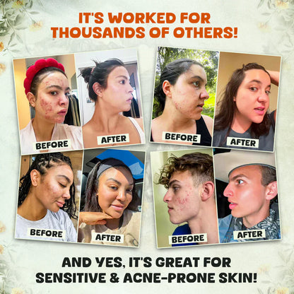 Organic Tallow & Manuka Balm – Face, Body & Lip Care (4oz)