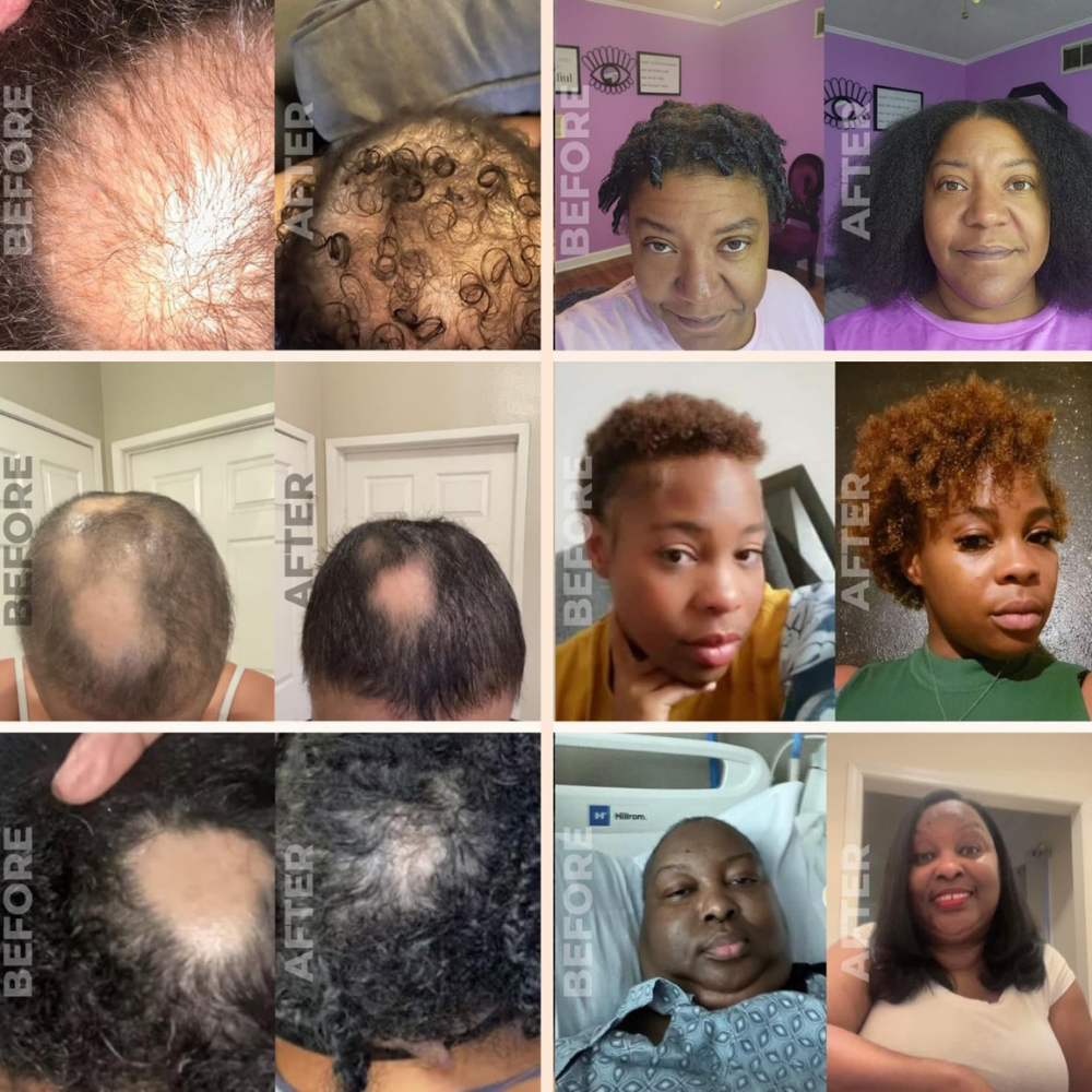 Natural Hair Growth Oil