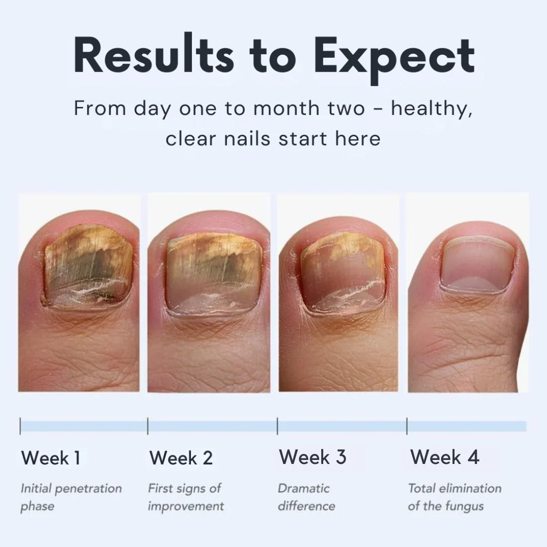 ViralLush™ Antifungal Pen