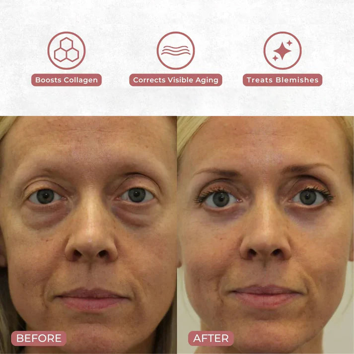 neck-eye-care-set-tighten-smooth-hydrate-2897