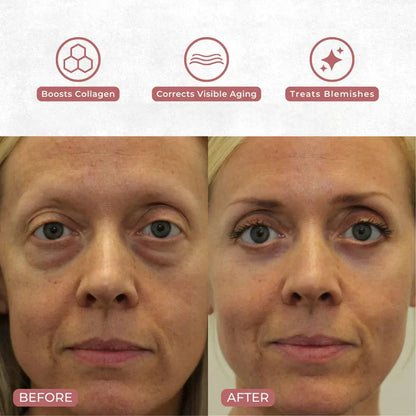 neck-eye-care-set-tighten-smooth-hydrate-2897