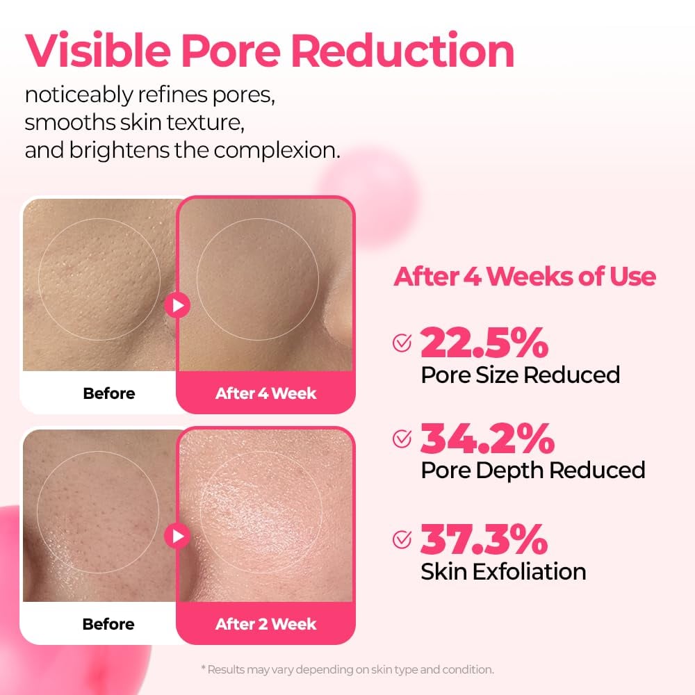 pore-spot-care-duo-5474