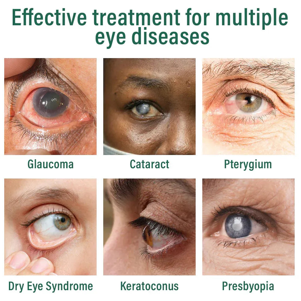 Brevoxa® Nano Eye Drops Serum